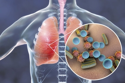 Cu stafilococul auriu la gradinita. Cum ii afecteaza pe copii aceasta bacterie?