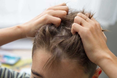 Pediculoza sau infestarea cu păduchi – Cum ameliorezi mâncărimea pielii la un copil?